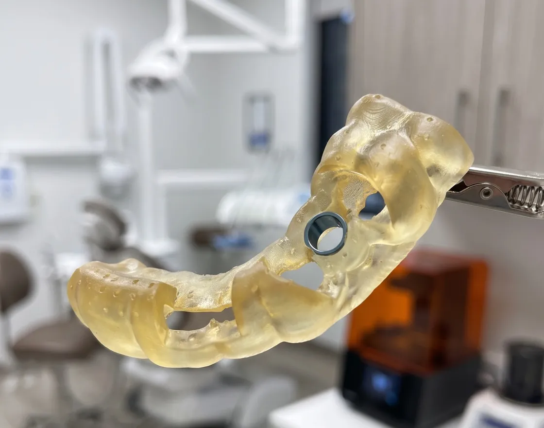 Guía quirúrgica impresa con un anillo metálico, sostenida por una pinza en un box dental